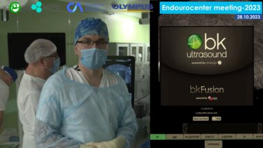 Петов В.С. - Трансректальная FUSION-биопсия свободной рукой на bkFusion