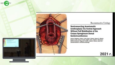 Богданов А.Б., Лоран О. - Сосудосберегающая операция Г. Джордана