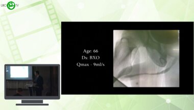 Мамаев И.Э. - Стриктура ладьевидной ямки, ventral inlay — это возможно