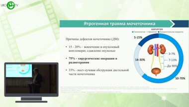 Румянцева Д.И., Носов А.К., Мамижев Э.М., Щекутеев Н.А. - Клинический случай. Интраоперационная ICG-визуализация ятрогенного дефекта мочеточника