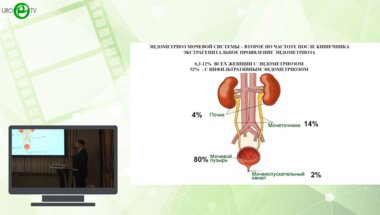 Тарендь Д.Т., Лысенок А.Ю., Высоцкий А.Ю. - Лапароскопическая коррекция урологических проявлений эндометриоза
