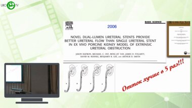 Григорьев Н.А. - Тандемное стентирование верхних мочевых путей