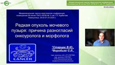 Старцев В.Ю. - Пограничный случай редкой опухоли мочевого пузыря. Причина спора онкоуролога и морфолога