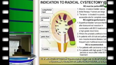 Владимир Медведев "Лапароскопическая цистпростатэктомия тонкости"