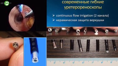 Мартов А.Г. - Ретроградная интраренальная хирургия - революция в лечении урологических заболеваний