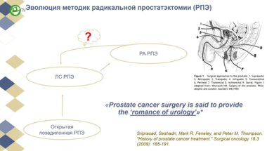 Носов А.К. - Робот-ассистированная хирургия в лечении рака простаты