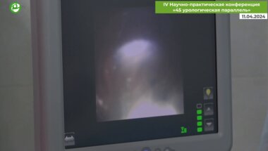 Санжаров А.Е. - Лапароскопическая пиелопластика справа (рецидив) + камни почки