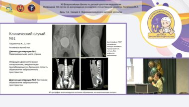 Каганцов И.М., Кондратьева Е.А. - Редкие случаи сочетания полного удвоения почки с другими аномалиями верхних мочевых путей