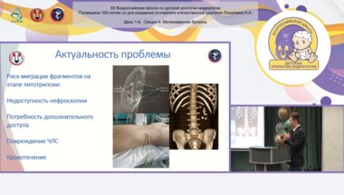 Арустамов Л.Д., Вардак А.Б., Рудин Ю.Э. - Прием перемещения конкремента из недостижимой нефроскопии чашечки