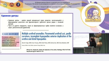 Тарусин Д.И. - Клиническое наблюдение – полное удвоение уретры при гипоспадии