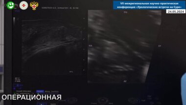 Галкин А.В. - Фьюжн-биопсия предстательной железы