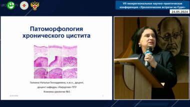 Галкина Н.Г. - Морфологические изменения мочевого пузыря при хроническом рецидивирующем цистите
