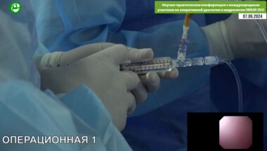 Григорьев Н.А. - Ретроградная пиелолитотрипсия