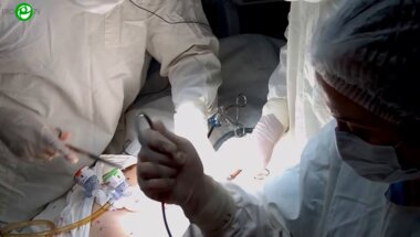 Еременко А.Н. - 3D ВЛС интерфасциальная нервосберегающая радикальная простатэктомия с реконструкцией уретры