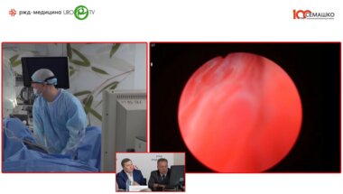 Бурлака О.О. - Гольмиевая высокоэнергетическая энуклеация простаты с технологией Moses (HoLep)