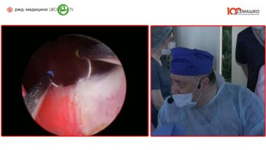Камалов А.А. - Тотальная классическая трансуретральная биполярная резекция простаты