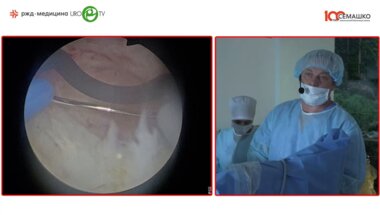 Севрюков Ф.А. - Плазменная трансуретральная энуклеация простаты (TUEB)