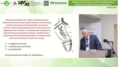 Капто А.А. - Альтернативные фаллоэндопротезированию методы хирургического лечения веногенной ЭД