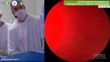 Юнкер А.И., Али С.Х. - ECIRS. Комбинированная перкутанная и трансуретральная лазерная нефролитотрипсия