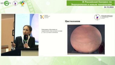 Волокитин Е.В. - Биполярная ТУР мочевого пузыря