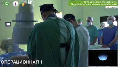 Новоселов В.Г. - Перкутанная нефролитотрипсия в положении на животе