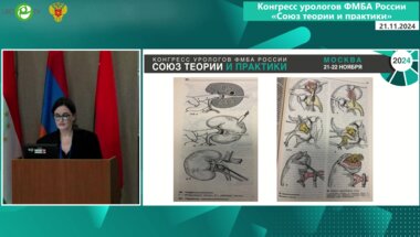 Хитрых А.М. - Место лапароскопии в лечении МКБ