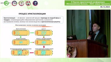 Войтко Д.А. - Возможности оценки антикристаллизационной активности мочи