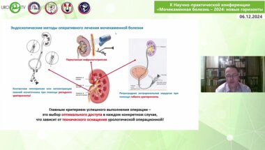 Неймарк Б.А. - Современные методы в лечении мочекаменной болезни