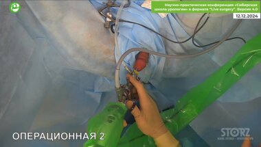 Байков Н.А. - Лапароскопическая уретеронефрэктомия