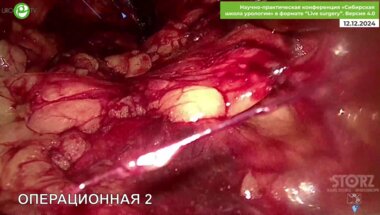 Операция Галлямова Э.А. (вне конкурса)