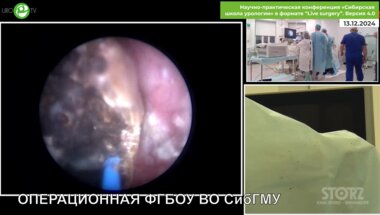 Али С.Х. - ПНЛТ