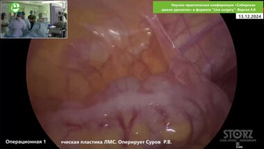 Суров Р.В. - Хирургическая коррекция гипоспадии