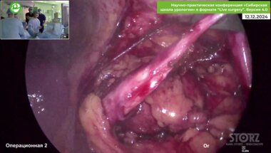 Суров Р.В - Пластика ЛМС