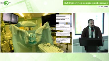 Доломанов К.А. - Мочеточник на 3 – 5 – 7 сутки предстентирования. Физиологические и хирургические последствия