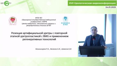 Казихинуров Р.А. - Резекция артифициальной уретры с формированием уретральной площадки из BMG с использованием регенеративных технологий