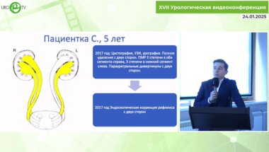 Лобач А.Ю. - Лапароскопическая двухсторонняя реимплантация мочеточников при их полном удвоении с двух сторон