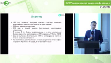 Исаев Т.К. - Лапароскопическое удаление «гигантского» коралловидного камня почки (13.5 см)