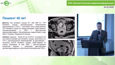 Монаков Д.М. - Робот-ассистированная цистпростатвезикулэктомия с интракорпоральным формированием необладдера