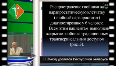 Нечипоренко Н.А. - Абсцесс предстательной железы диагностика и малоинвазивное лечение. 