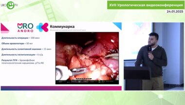 Тызьо Д.В. - Резекция подковообразной почки. Опыт Университетской клиники РНИМУ им.Н.И. Пирогова