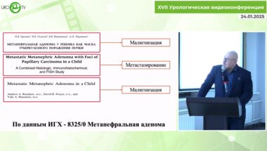 Шмыров О.С. - Лапароскопическая резекция новообразования почки сложной локализации