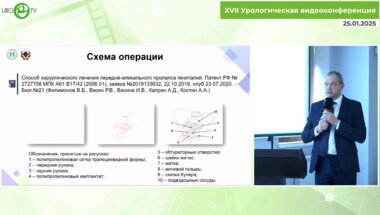Васин Р.В. - Лапароскопическая пектопексия в сочетании с влагалищным этапом установки сетчатого имплантата при пролапсе гениталий