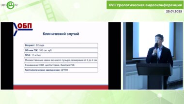 Лугинов Б.А. - Симультанная экстраперитонеоскопическая аденомэктомия с удалением крупных камей МП