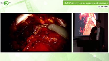 Степаненков А.М. - А так можно было?