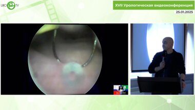 Шкодкин С.В. - Пузырно-влагалищный свищ, влагалищная коррекция