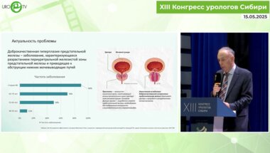 Неймарк А.И. - Подходы к терапии больных с ДГПЖ и хроническим простатитом. Результаты наших наблюдений