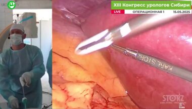 Новиков А.Б. - Лапароскопическая резекция правой почки