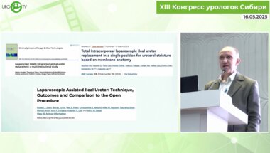 Рева С.А. - Лапароскопическая тотальная заместительная кишечная пластика правого мочеточника