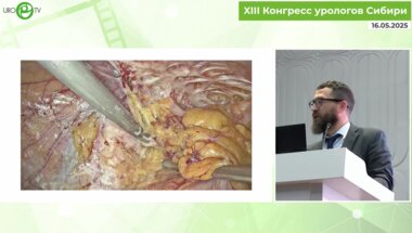 Холтобин Д.П. - Репростатэктомия