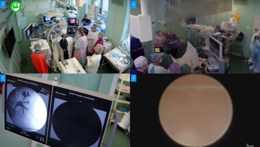 Мартов А.Г., Андронов А.С. - Комбинированная интраренальная хирургия c тулиевым волоконным лазером Flex-XC1+MIP S